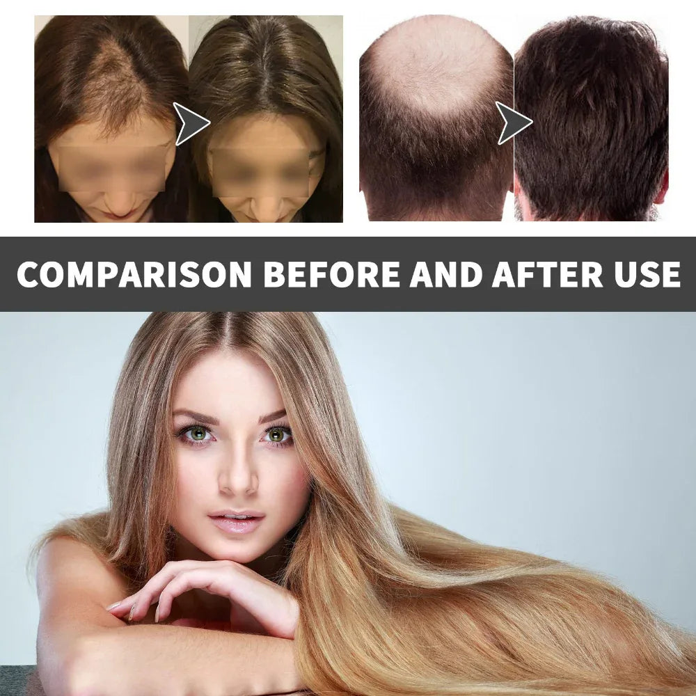 Hair Strengthening Hair Serum Growth Oil