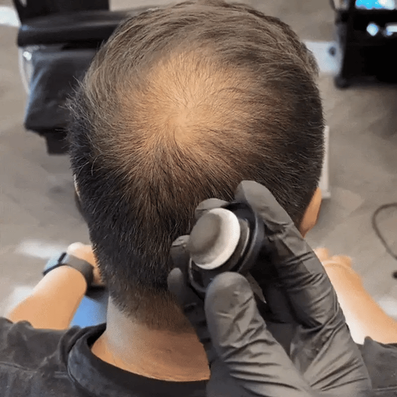 Hairline Powder