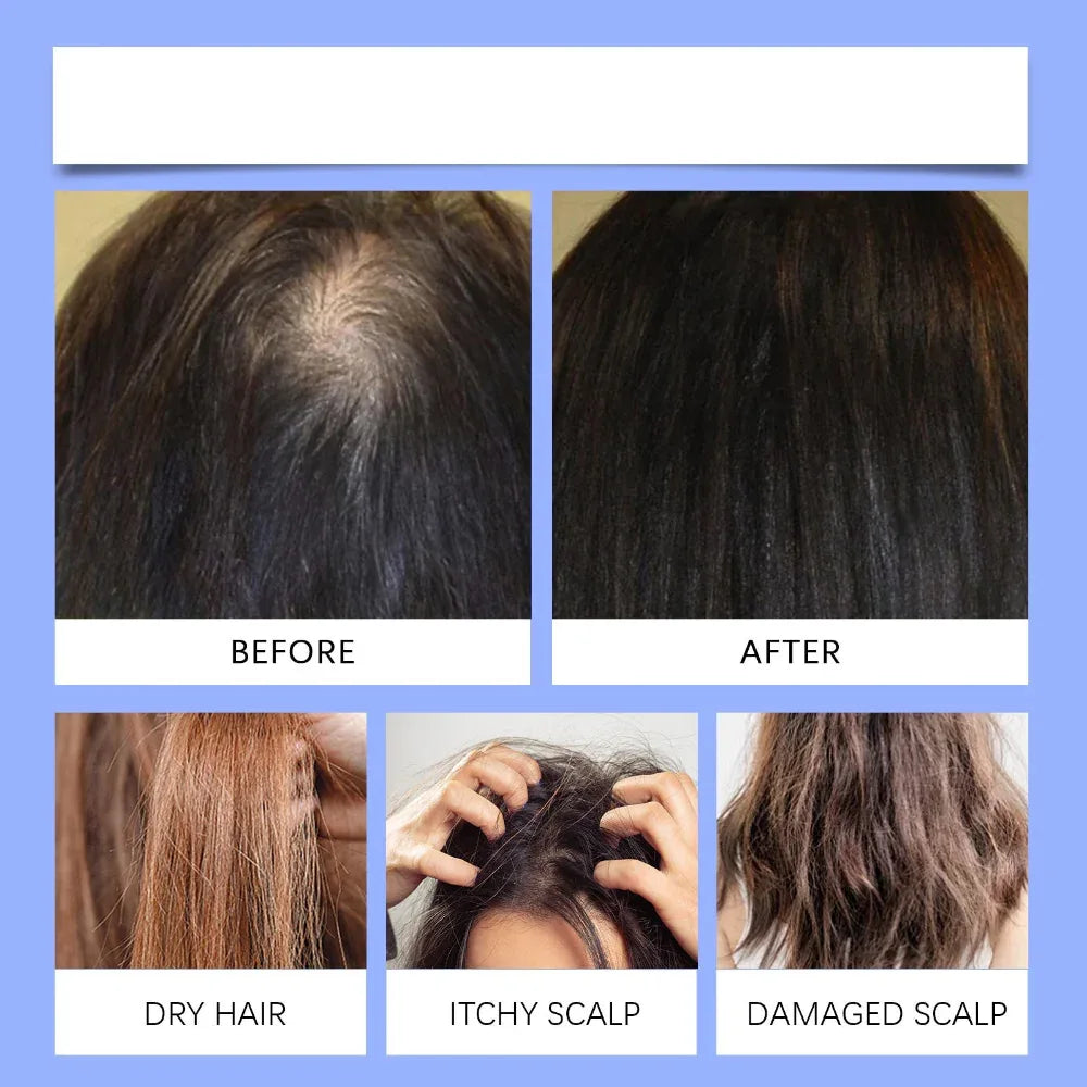 Moisturizing & Nourishing Biotin Hair Care Oil