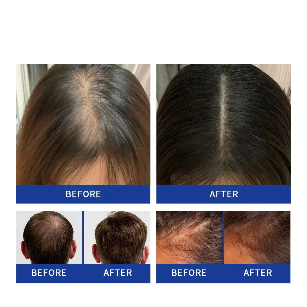Gentle Nourishing Scalp Strong Hair Soft And Shiny Hair Care Spray