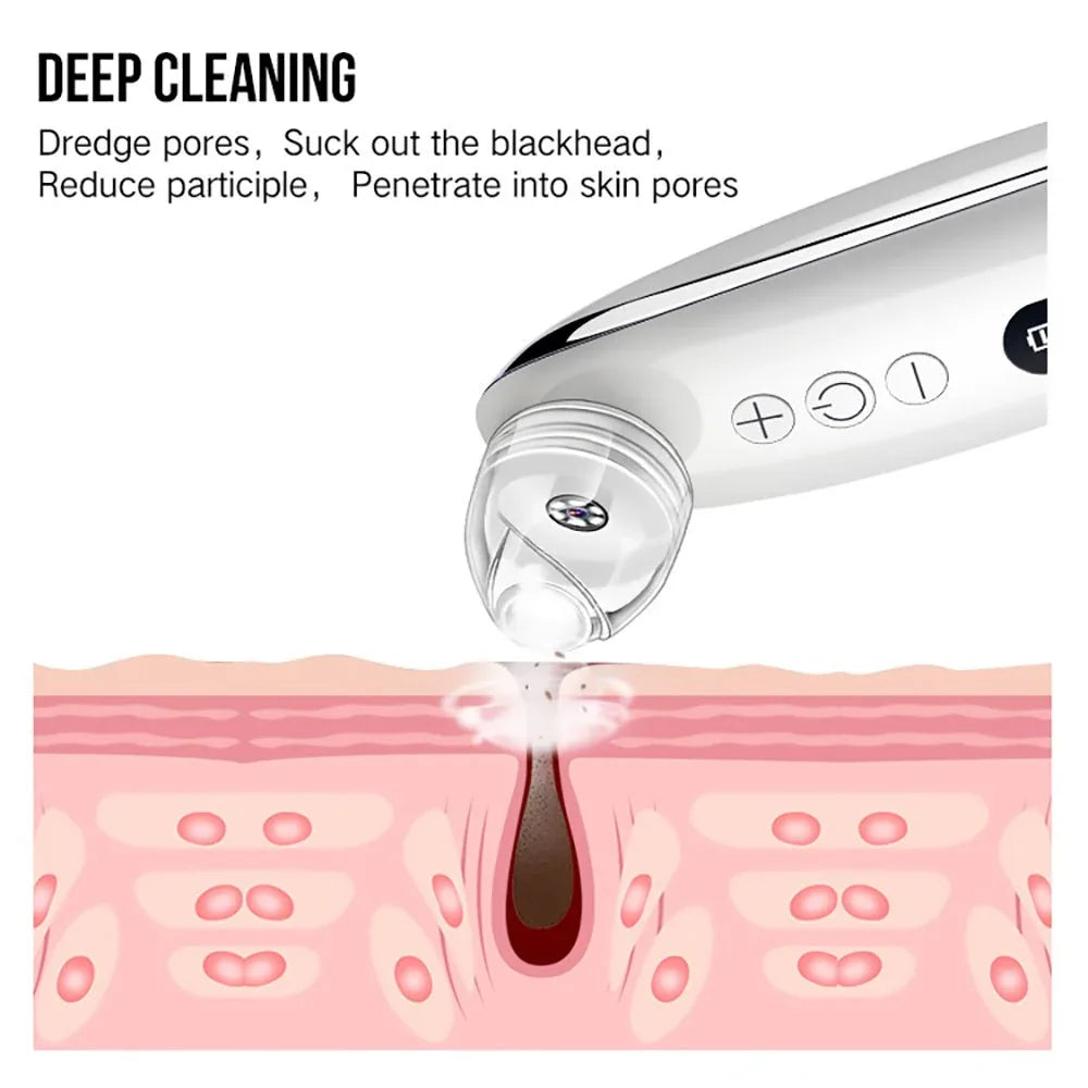 Comfortable & Effective Facial Blackhead Remover