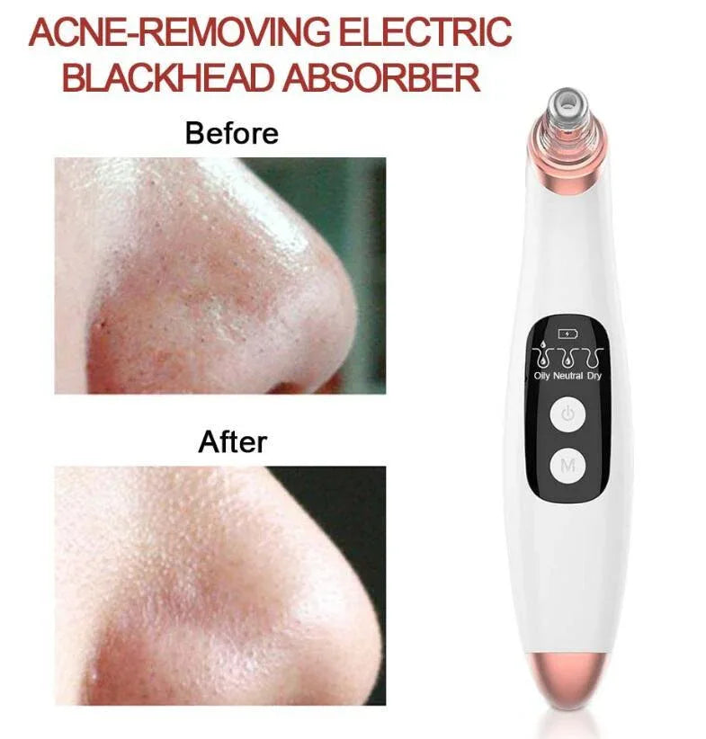 USB Electric Vacuum Suction Blackhead Remover With LED Display For Deep Pore Cleansing